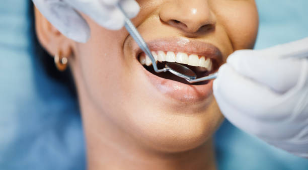 Professional  Dental Services in Mocksville, NC